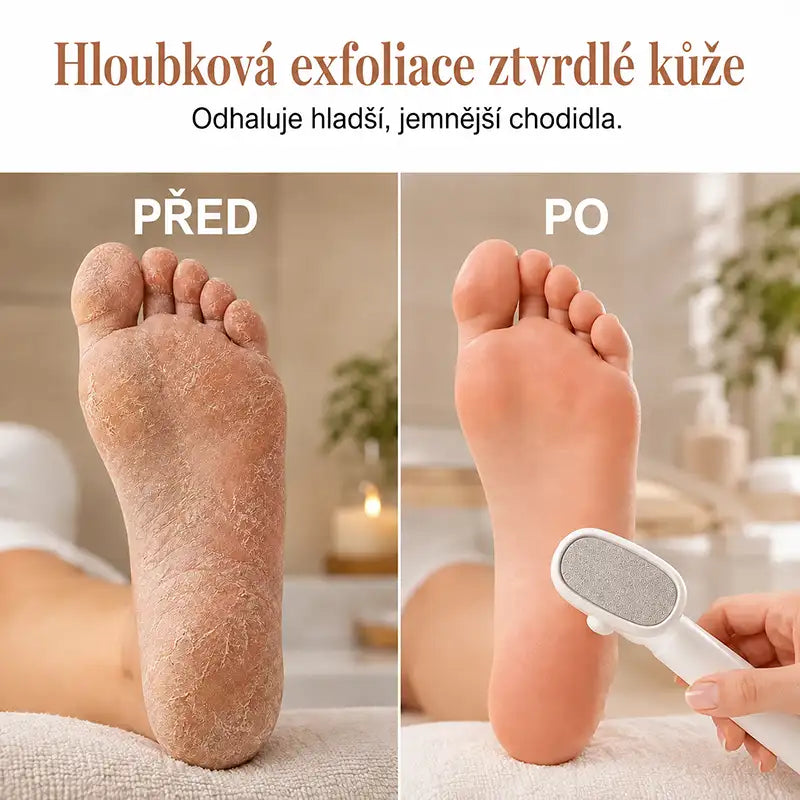 Odstraňovač mozolů jedním tahem